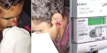 കേടായ മീറ്റർ മാറ്റിവെച്ചതിൽ വൈരാഗ്യം, കെഎസ്ഇബി ജീവനക്കാരെ ജീപ്പിടിപ്പിച്ച് വീട്ടുടമ, ജാക്കി ലിവർ കൊണ്ടടിച്ചു