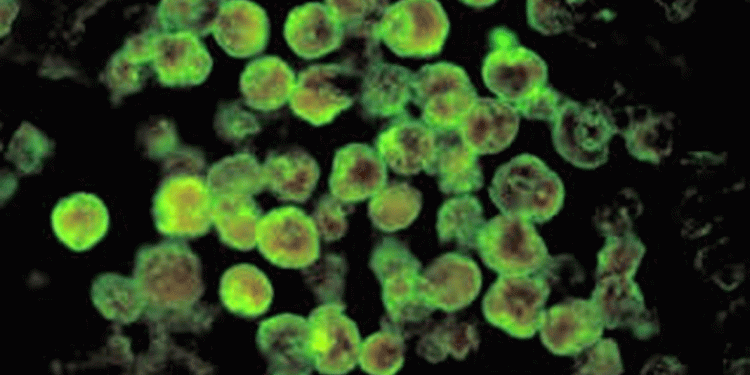 വീണ്ടും അമീബിക് മസ്‌തിഷ്‌ക ജ്വരം ; കോഴിക്കോട് ചികിത്സയിലുള്ള മൂന്നര വയസുകാരന് രോഗം സ്ഥിരീകരിച്ചു