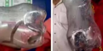 മകളുമായി സർക്കാർ ആശുപത്രിയിലെത്തിയ അമ്മയെ പാമ്പ് കടിച്ചു