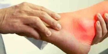 യൂറിക് ആസിഡ് തോത് കുറയ്ക്കാന്‍ വീട്ടില്‍ ചെയ്യേണ്ട എട്ട് കാര്യങ്ങള്‍