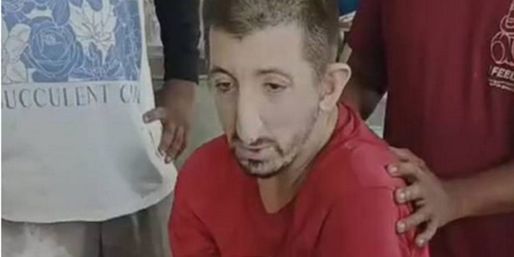 ഫോര്‍ട്ട് കൊച്ചിയില്‍ കാനയില്‍ വീണ് വിദേശിയുടെ കാലൊടിഞ്ഞു