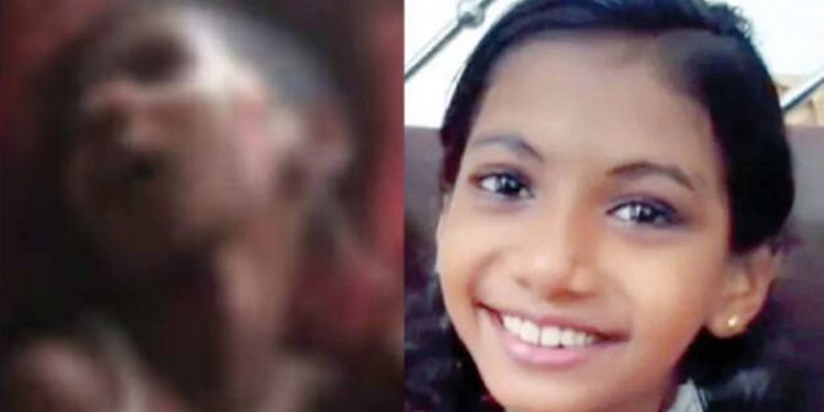 വടകരയില് കാർ ഇടിച്ച് നിർത്താതെ പോയ സംഭവത്തിൽ കോമയിൽ ആയ ഒമ്പത് വയസുകാരി ദൃഷാന ആശുപത്രി വിട്ടു