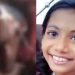 വടകരയില് കാർ ഇടിച്ച് നിർത്താതെ പോയ സംഭവത്തിൽ കോമയിൽ ആയ ഒമ്പത് വയസുകാരി ദൃഷാന ആശുപത്രി വിട്ടു