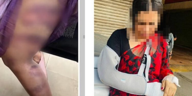 കൊച്ചിയിൽ ട്രാൻസ്ജെൻഡർ യുവതിയെ മർദ്ദിച്ച സംഭവത്തിൽ രണ്ട് പേർ കസ്റ്റഡിയിൽ