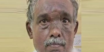 വനിതാ കൗണ്‍സിലറുടെ ബാഗ് മോഷ്ടിച്ചുകടന്ന സംഭവത്തില്‍ പ്രതി അറസ്റ്റില്‍