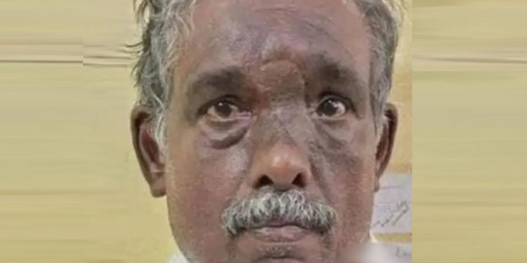 വനിതാ കൗണ്സിലറുടെ ബാഗ് മോഷ്ടിച്ചുകടന്ന സംഭവത്തില് പ്രതി അറസ്റ്റില്