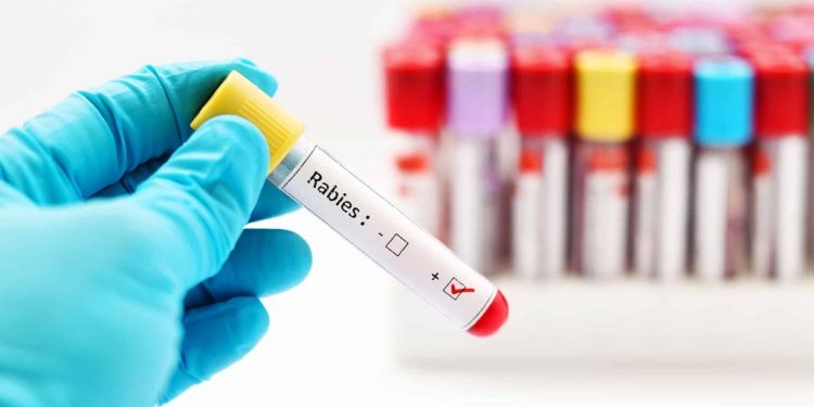 കൊല്ലത്ത് വാക്സിൻ എടുത്തിട്ടും ഏഴു വയസുകാരിക്ക് പേവിഷബാധ